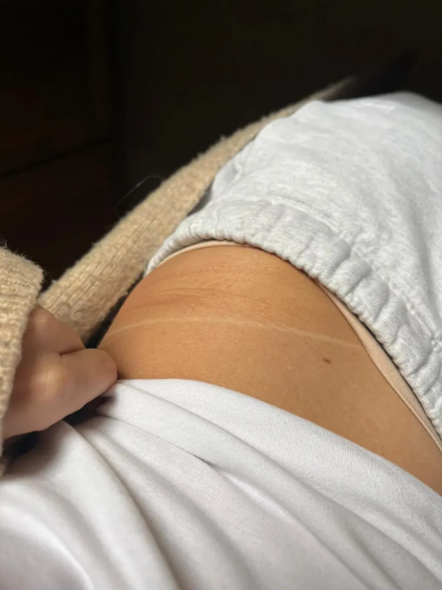 Słynna "tan line" – najlepszy i najbardziej satysfakcjonujący dowód na intensywność opalenizny.